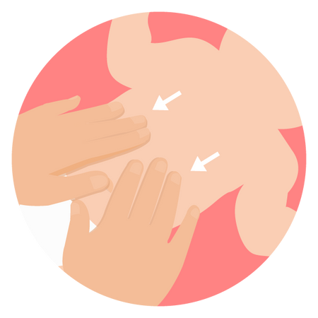 NoseFrida Windi Kateter Rektalny