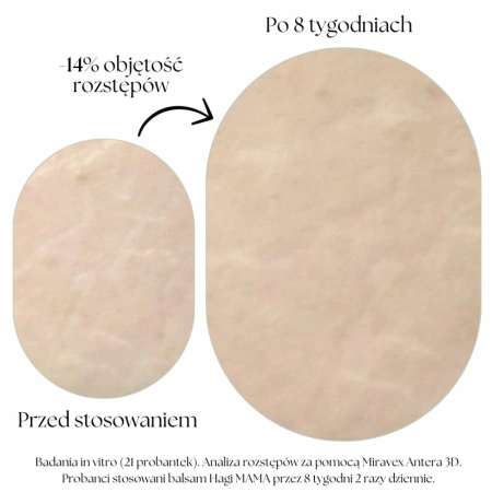 Hagi Naturalny Balsam Przeciw Rozstępom dla Kobiet od 1 dnia Ciąży 200 ml